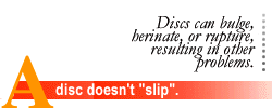 A disc doesn't slip.