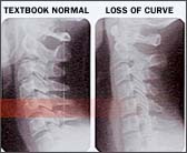 Photo of xray images.