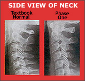 Side view of neck.