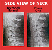 Side view of neck.